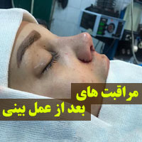 مراقبت های بعد از عمل بینی