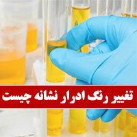 علت تغییر رنگ ادرار نشانه چیست