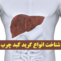 گرید های کبد چرب