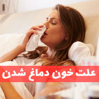 علت خون دماغ شدن