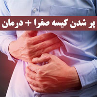 پر شدن کیسه صفرا
