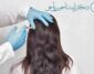 مقایسه مزوتراپی و پی آر پی برای درمان ریزش مو
