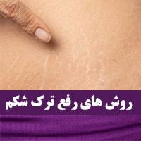 درمان ترک پوست شکم